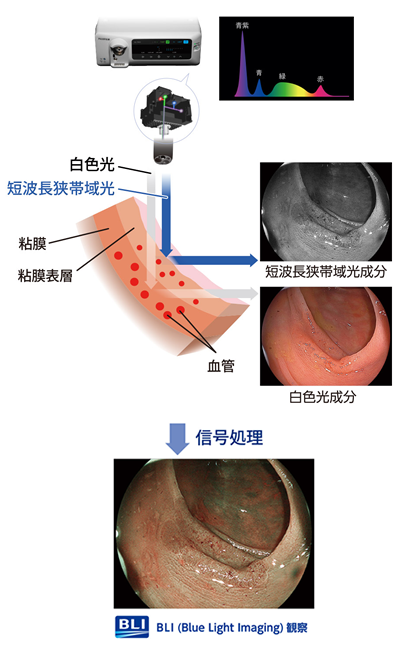 神戸市垂水区-みむら内科クリニック｜内科・消化器内科・内視鏡【胃